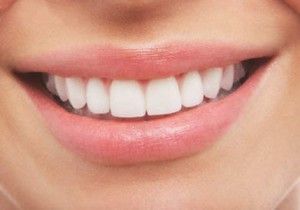 estética dental