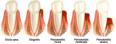 periodoncia