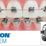 Dentista Reus Ortodoncia