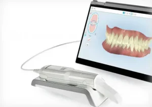 Tecnología digital para implantes en Dental Ibarz Reus Escáner 3D dental en Clínica Dental Ibarz Reus