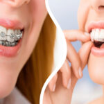 Ortodoncia: mejora tu sonrisa Dentista Reus Ortodoncia